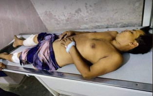 সালথায় ইউপি সদস্য ইমরুল খানের উপর বর্বরচিত হামলা 