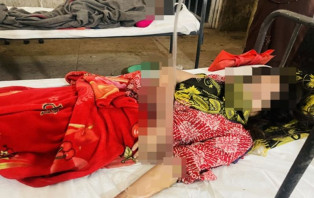 ব্লেড দিয়ে দুই গৃহবধুর হাত ও চুল কাটলো স্বামীরা!