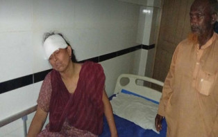 ছেলের চাইনিজ কুড়ালের আঘাতে মা ছটফট করছে হাসপাতালে 
